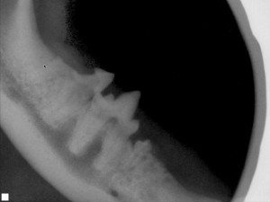 xray tooth resorption